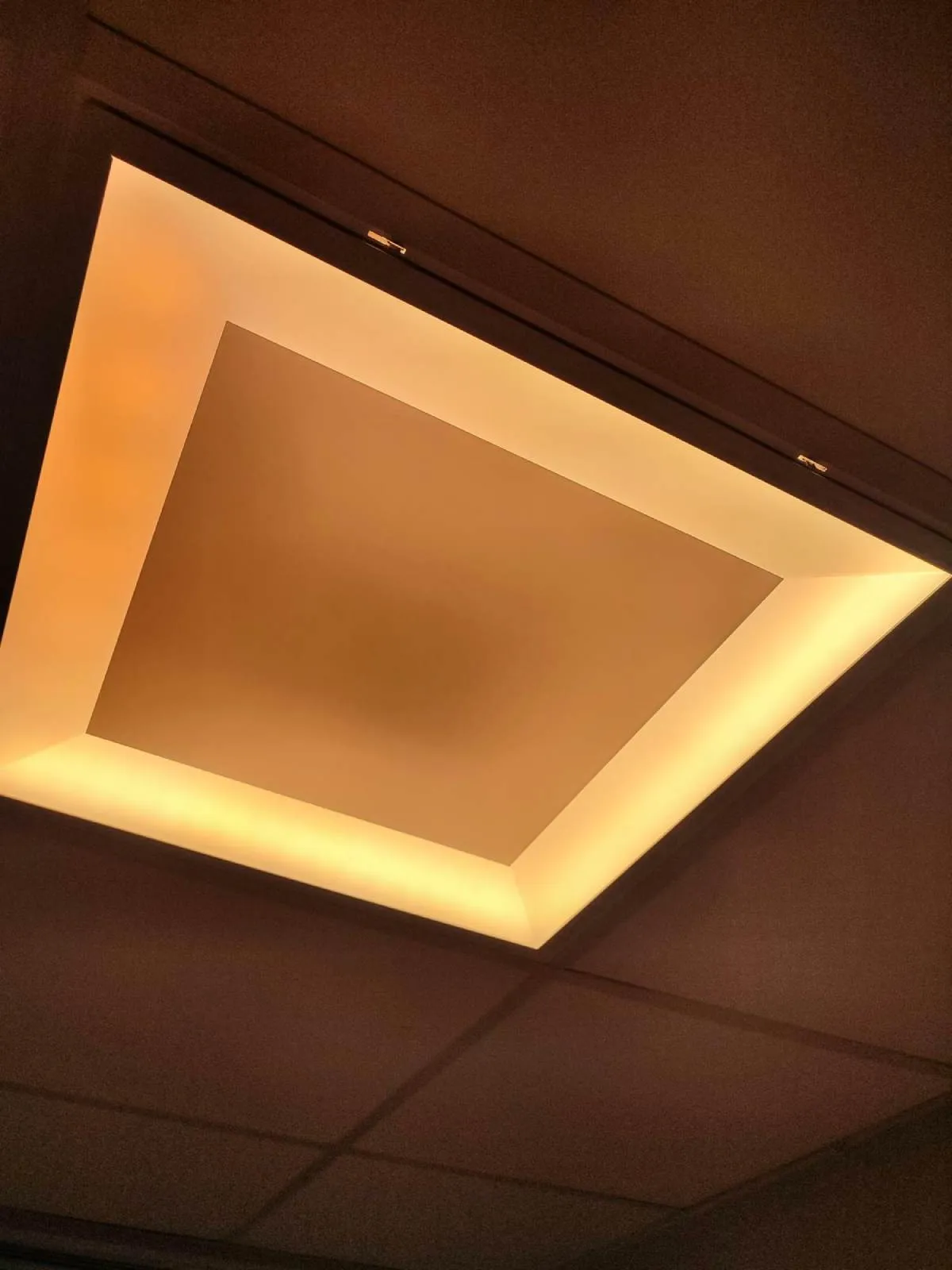 Pediatric Cardiac Icu